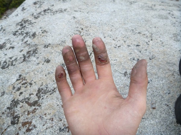 This is what my hand looked like at the top of the route