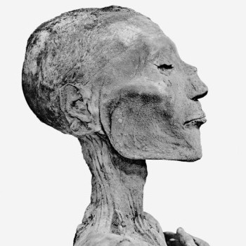 mummy of ramses the fifth with pock marks that some believe to have be...